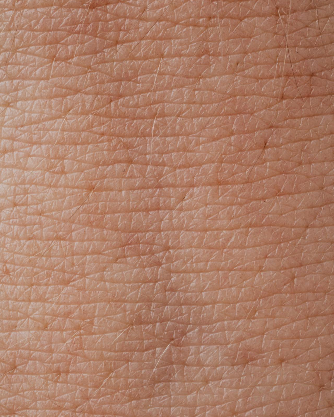 Image_peau